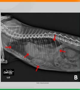 Radiografia lateral de tórax com ruptura diafragmática