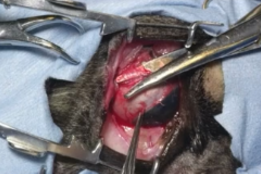 Dissecção dos músculos extraoculares durante a enucleação