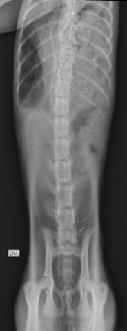 Radiografia torácica dorsoventral