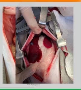 Transoperatório da redução dos órgãos