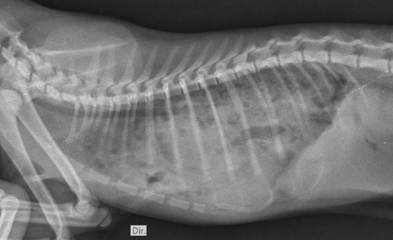 Radiografia torácica lateral, segunda projeção
