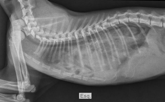 Radiografia torácica lateral com ruptura diafragmática