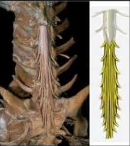 Dissecação anatômica e esquema das raízes da cauda equina