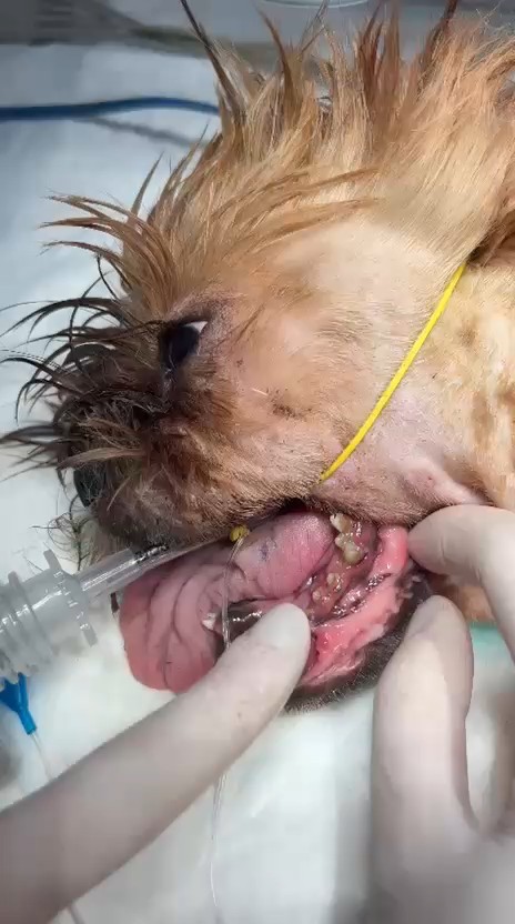 Paciente intubado posicionado para cirurgia mandibular