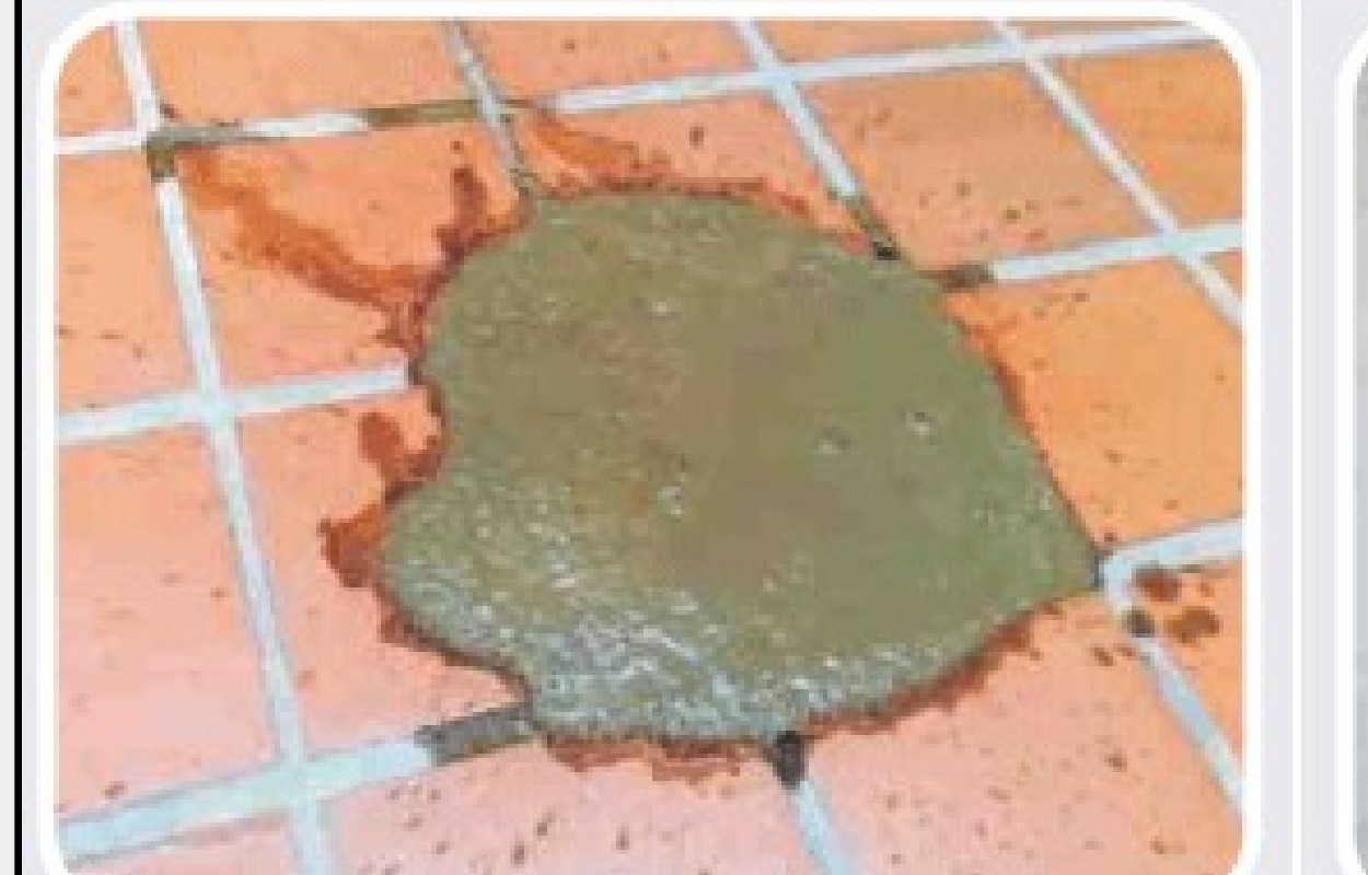 Diarreia de intestino delgado
