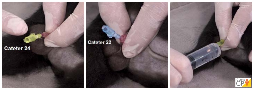 Sequência de imagens mostrando cateter 24, cateter 22 e seringa acoplada durante a desobstrução uretral em gato